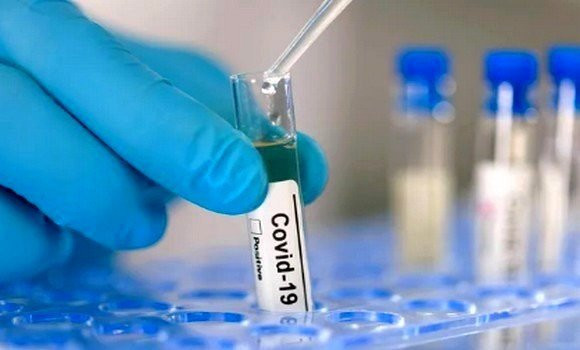 Coronavirus: aucun nouveau cas et aucun décès ces dernières 24h en Algérie