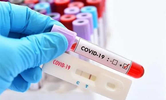 Coronavirus: 17 nouveaux cas et aucun décès