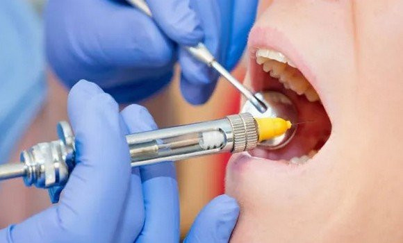 Le ministère de l’Industrie rassure sur la disponibilité des produits d’anesthésie dentaire
